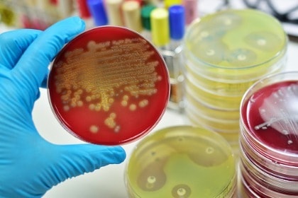 gloved hand holding bacteria culture petri dish