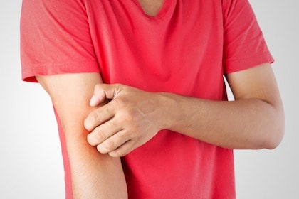 man scratching arm itchy skin