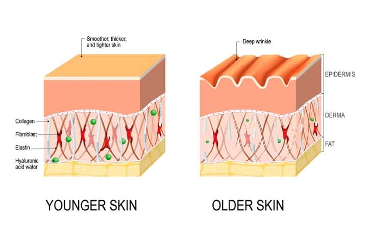 illustration-of-skin-aging-collagen-hyaluronic-acid-elastin
