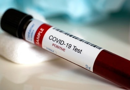 blood-test-samples-for-presence-of-coronavirus-covid-19