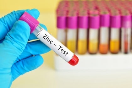 gloved-hand-holding-vial-of-blood-for-zinc-deficiency-test