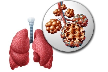 lung-pulmonary-alveoli