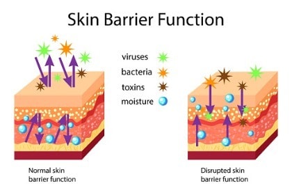 skin-barrier-function-normal-and-disrupted