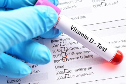 vitamin-d-serum-blood-test