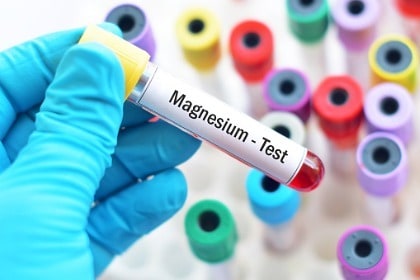 hand-holding-vial-of-blood-for-magnesium-serum-test