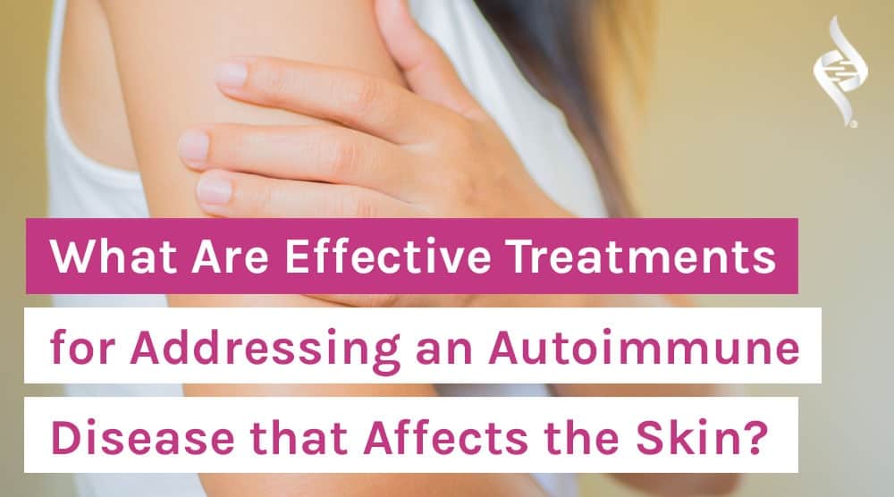 What Are Effective Treatments for Addressing an Autoimmune Disease that Affects the Skin?