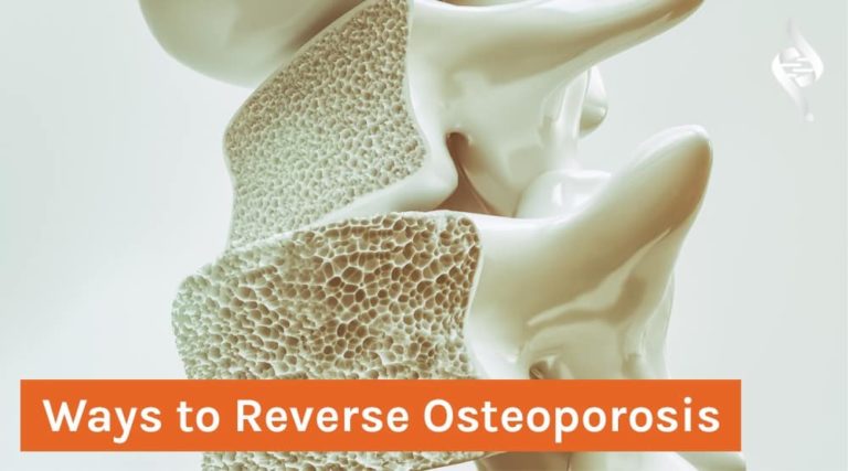 Ways to Reverse Osteoporosis