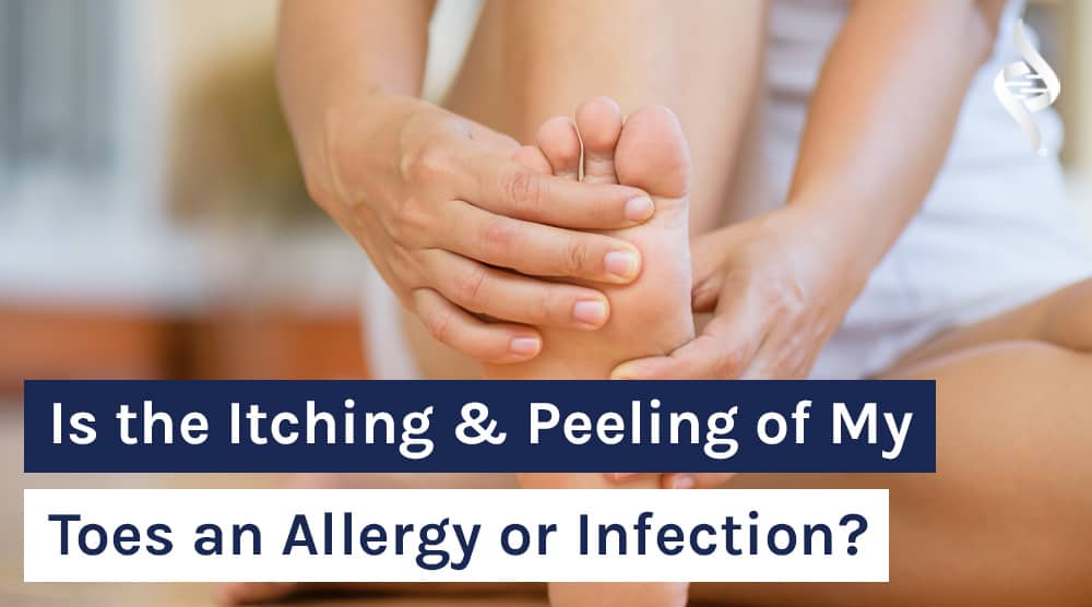 Is the Itching and Peeling of My Toes an Allergy or Infection
