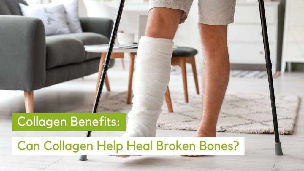 Collagen For Broken Bones | Your Key To Recovery