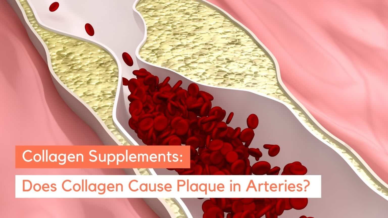 Does Collagen Clog Arteries? Here’s What Science Says Organixx