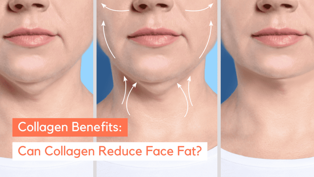 How Does Collagen Help with Face Fat? Learn the Facts