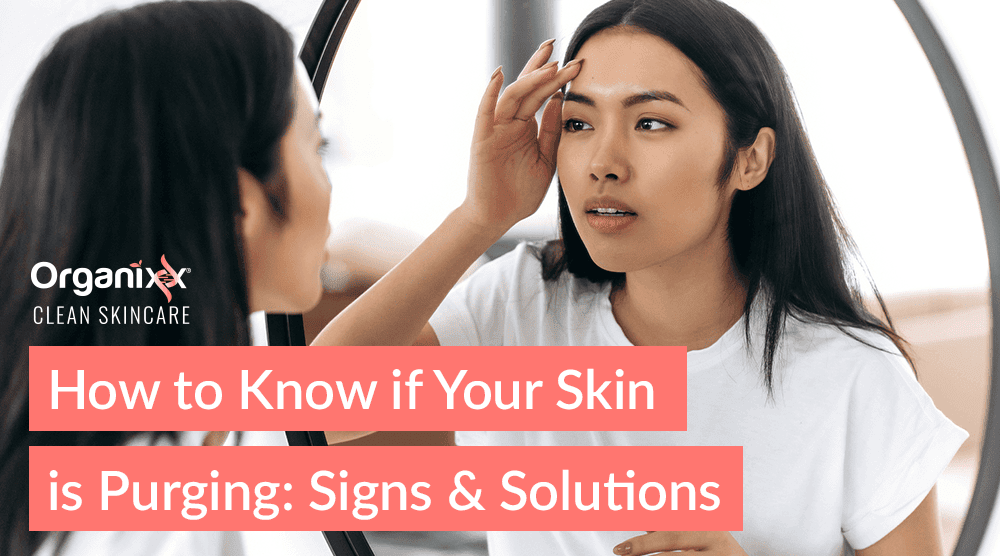 How To Know If Your Skin Is Purging: Signs & Solutions