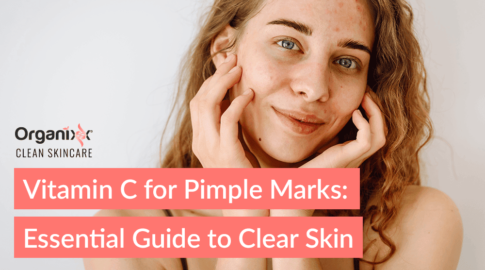 Vitamin C for Pimple Marks: Essential Guide to Clear Skin