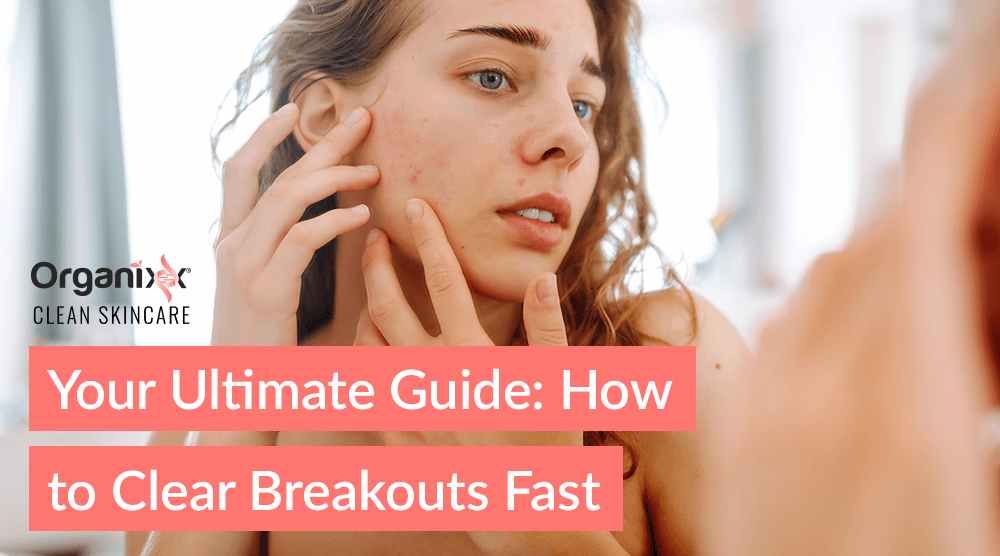 Your Ultimate Guide: How to Clear Breakouts Fast