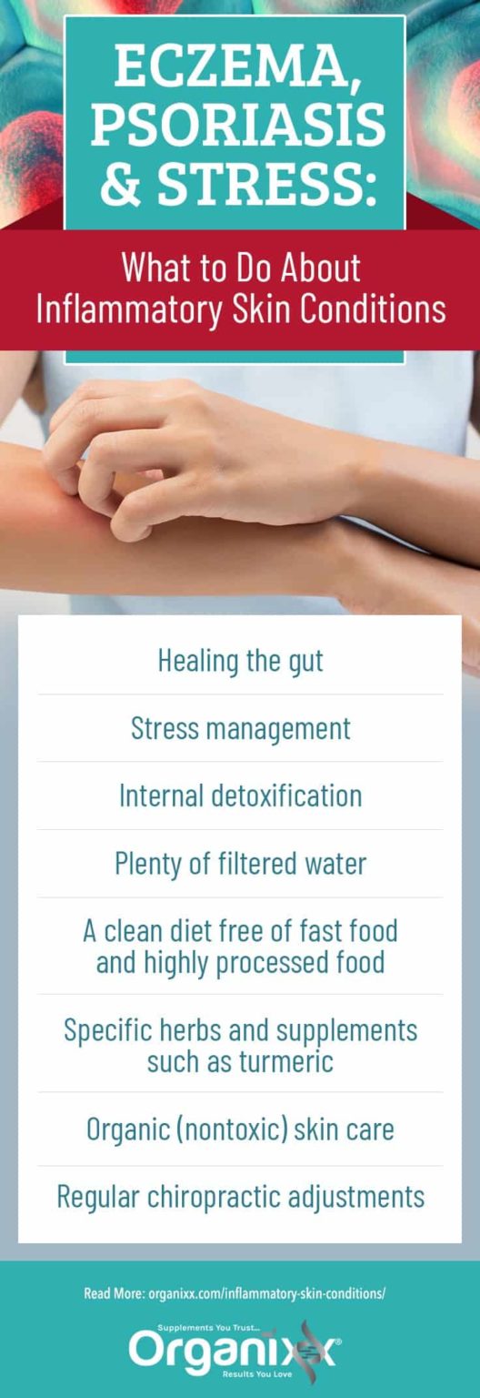 Eczema, Psoriasis & Stress: What to Do About Inflammatory Skin ...