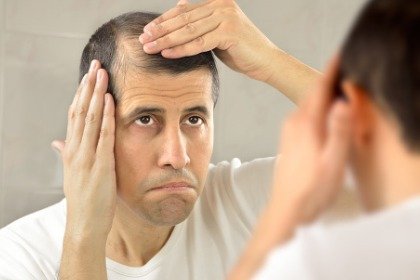 man looking at thinning hair in the mirror